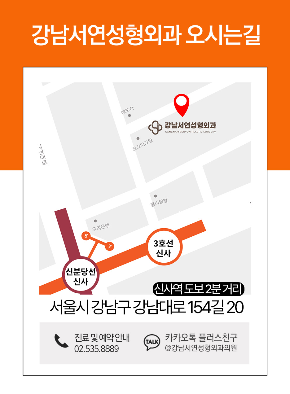 남자눈성형, 무쌍눈매교정 사진 17